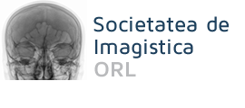 SIORL